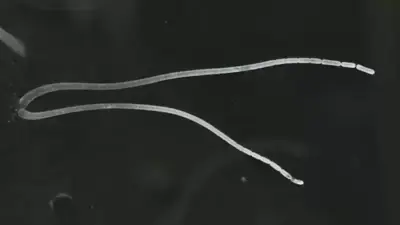 థియోమార్గ‌రిటా మాగ్నిఫికా.. అతి పెద్ద‌ బ్యాక్టీరియా