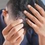 Hair Loss Prevention Foods | రాలిపోయే జుట్టుకు ఈ ఆహారాలతో ప్రాణం పోయండి!