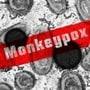 <p>Monkeypox</p>