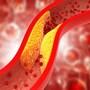 Control Cholesterol : ఈ నట్స్ తింటే కొలెస్ట్రాల్​ తగ్గుతుందట.. మీకు తెలుసా?