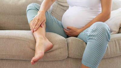 Swollen Feet in Pregnancy